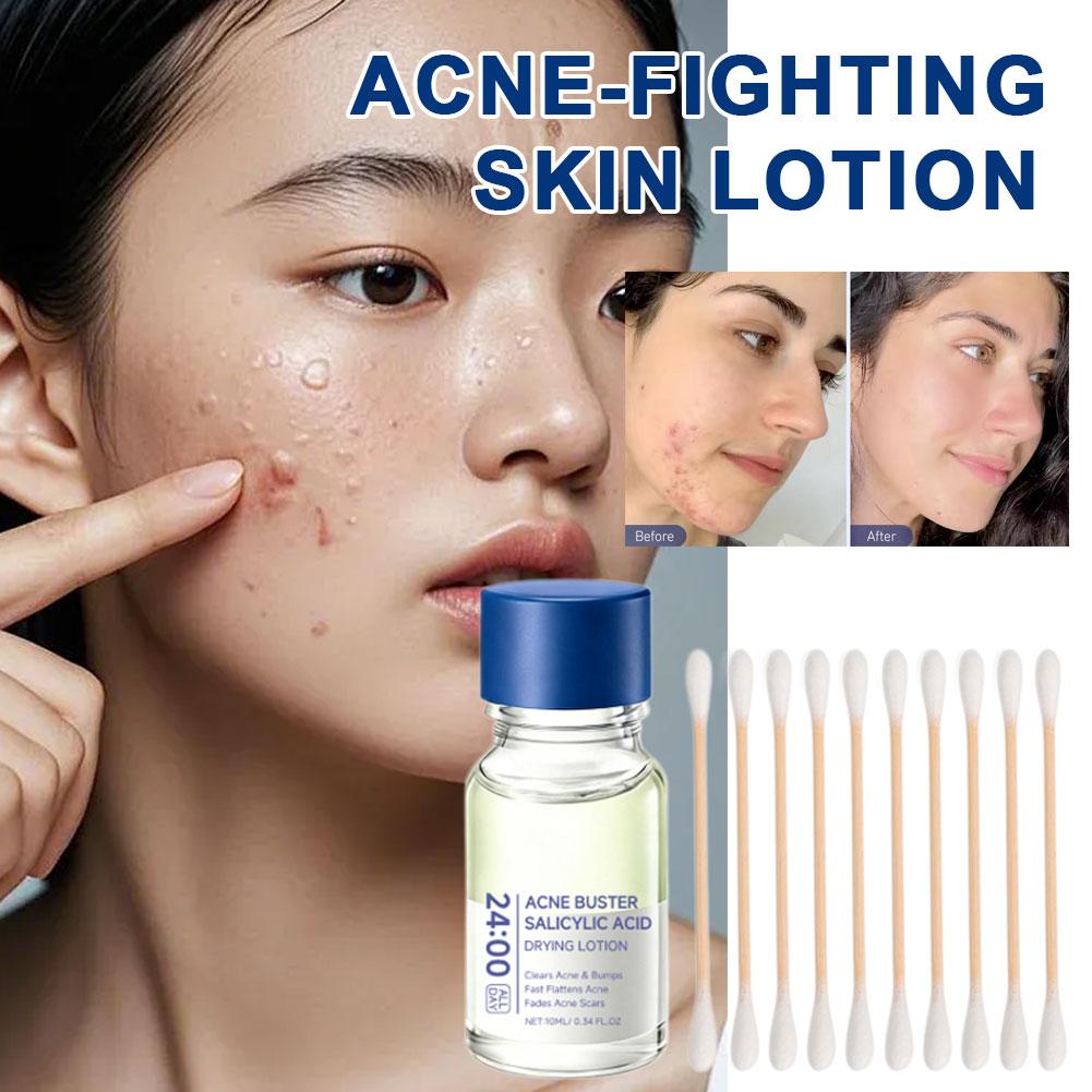 Azelaic Acid Serum - Salicylic Acid Acne Removal Face Serum