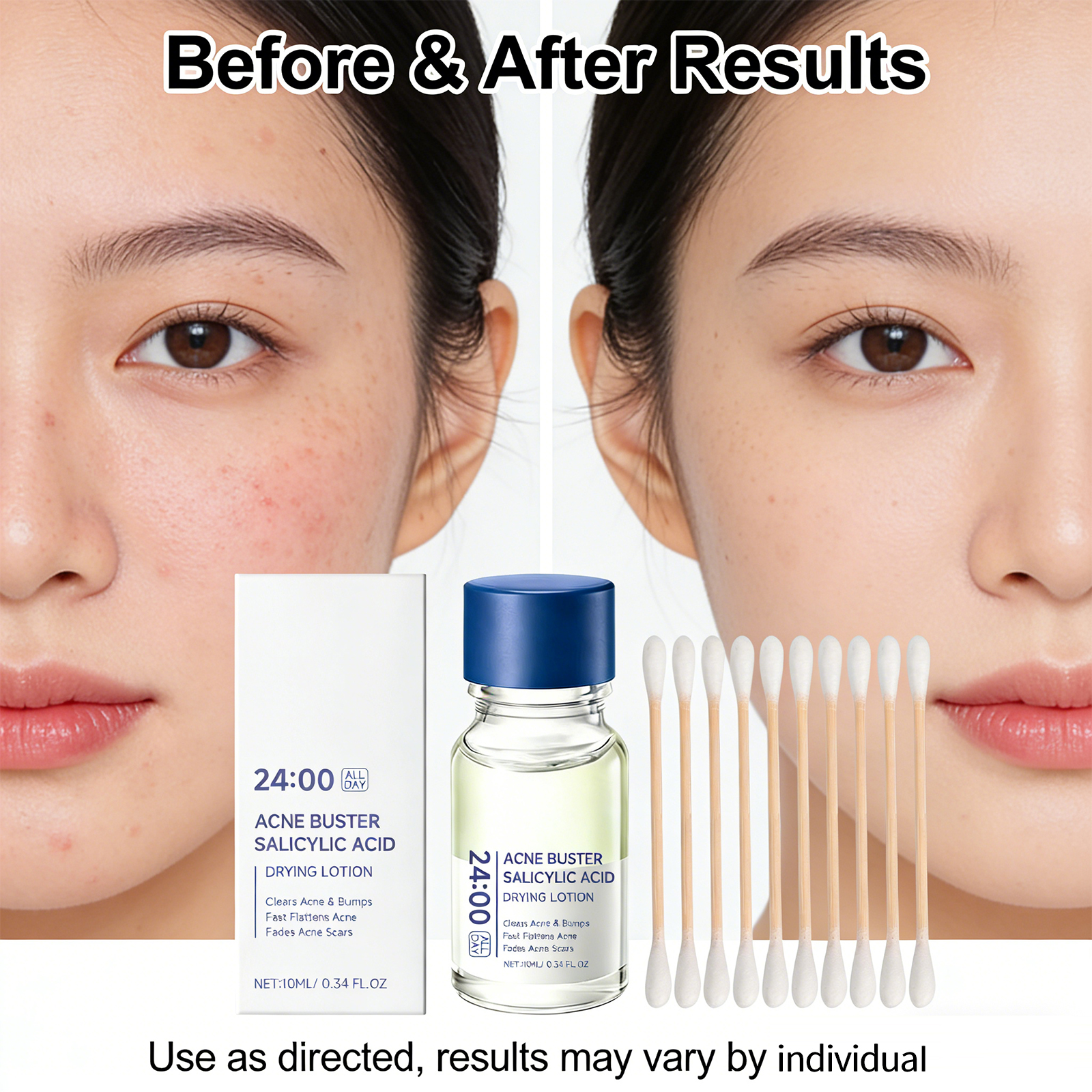 Salicylic Acid Drying Lotion A – Skincare Salicylic Acid recenzja i cena