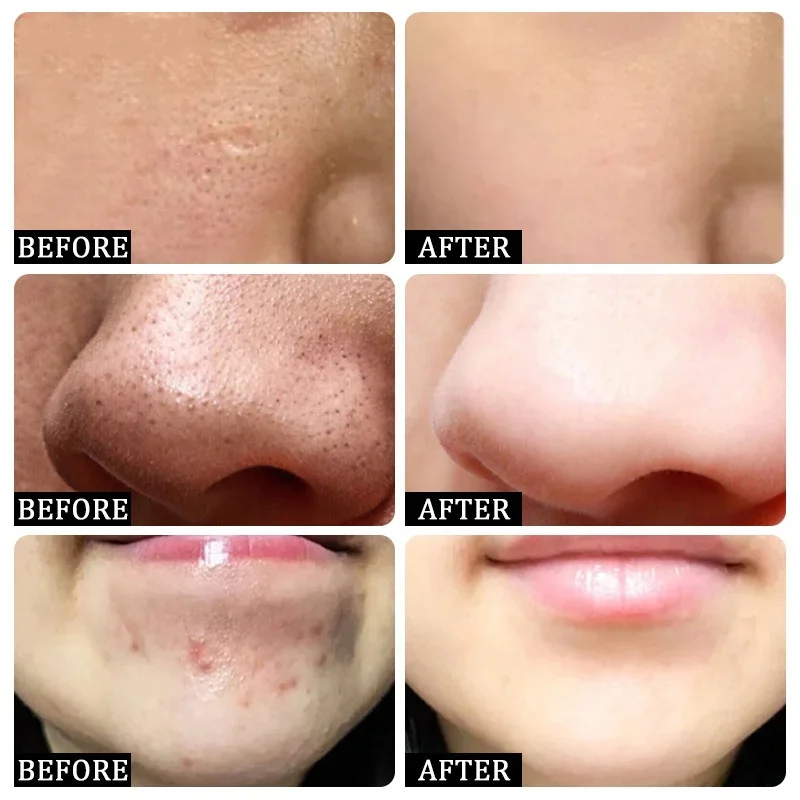 Salicylic Acid Pore Clearing C – Skincare Salicylic Acid recenzja i cena