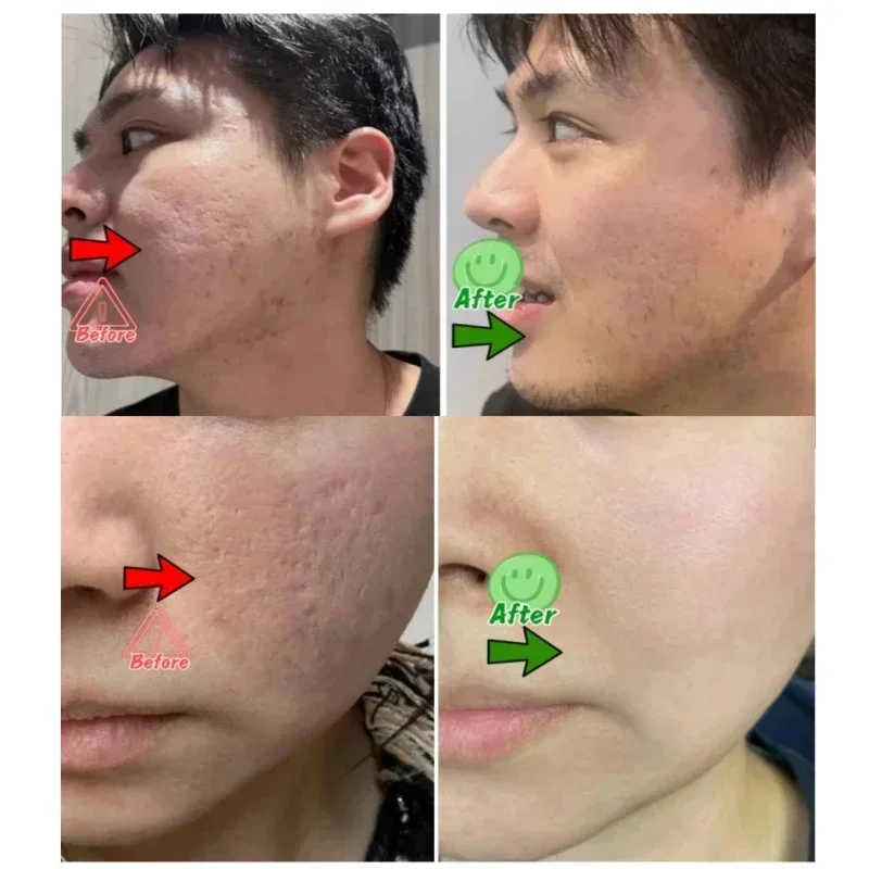 Salicylic Acid Pore Clearing C – Skincare Salicylic Acid recenzja i cena