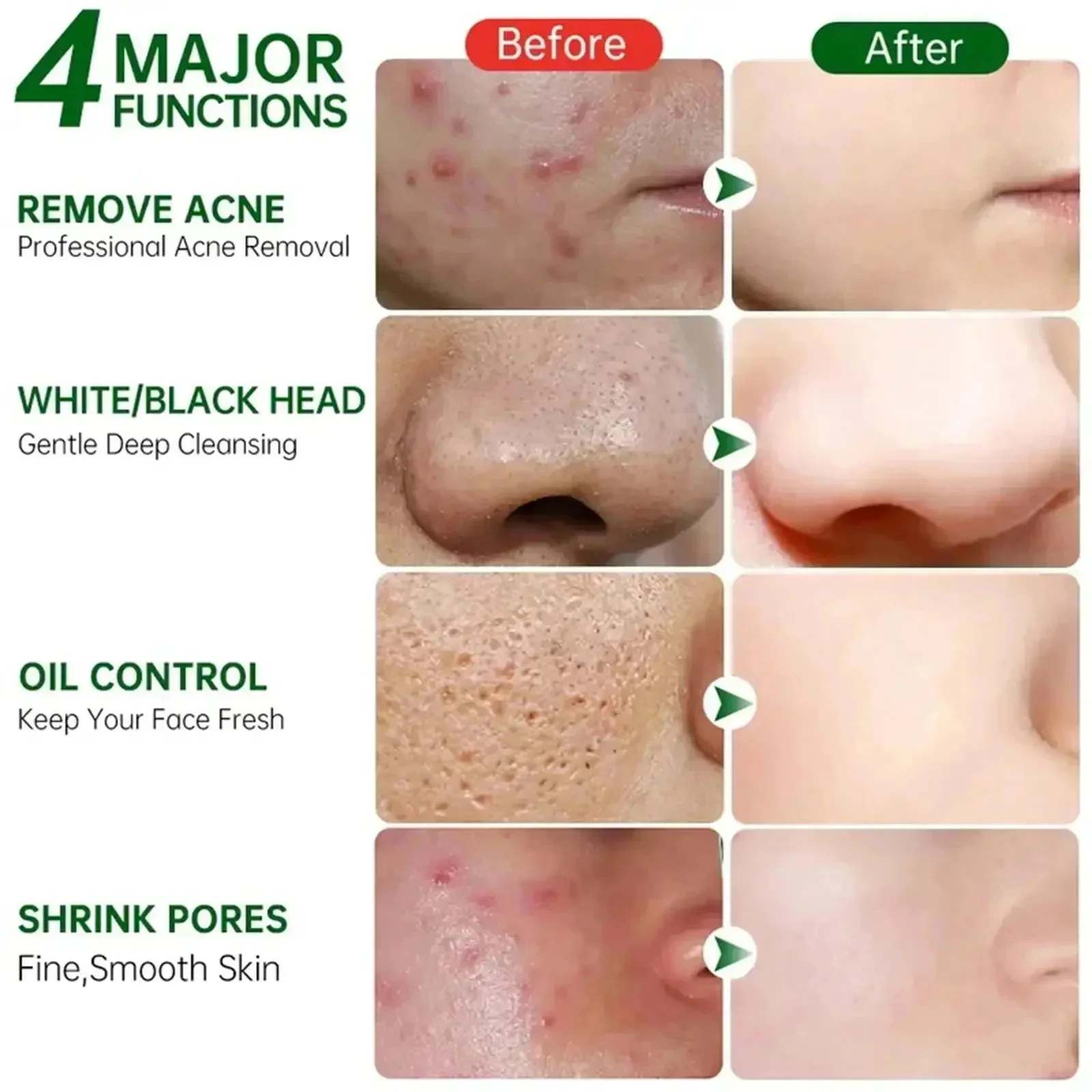 Salicylic Acid Pore Clearing C – Skincare Salicylic Acid recenzja i cena