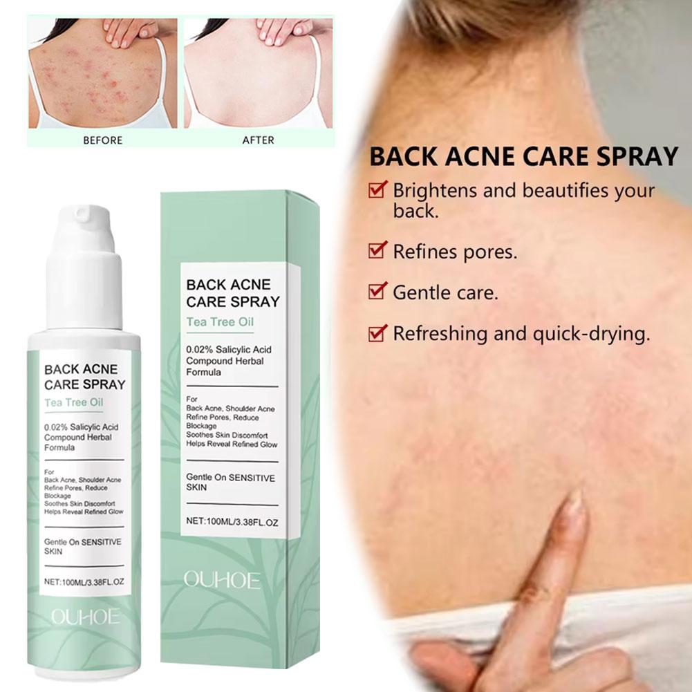 Salicylic Acid Back Acne Spray – Skincare Salicylic Acid recenzja i cena