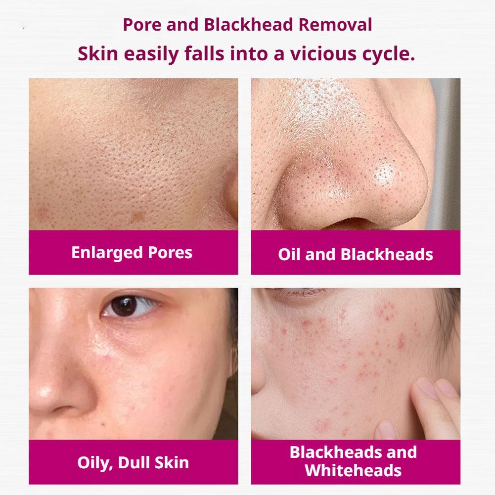 Salicylic Acid Shrink Pores Se – Azelaic Acid Serum recenzja i cena