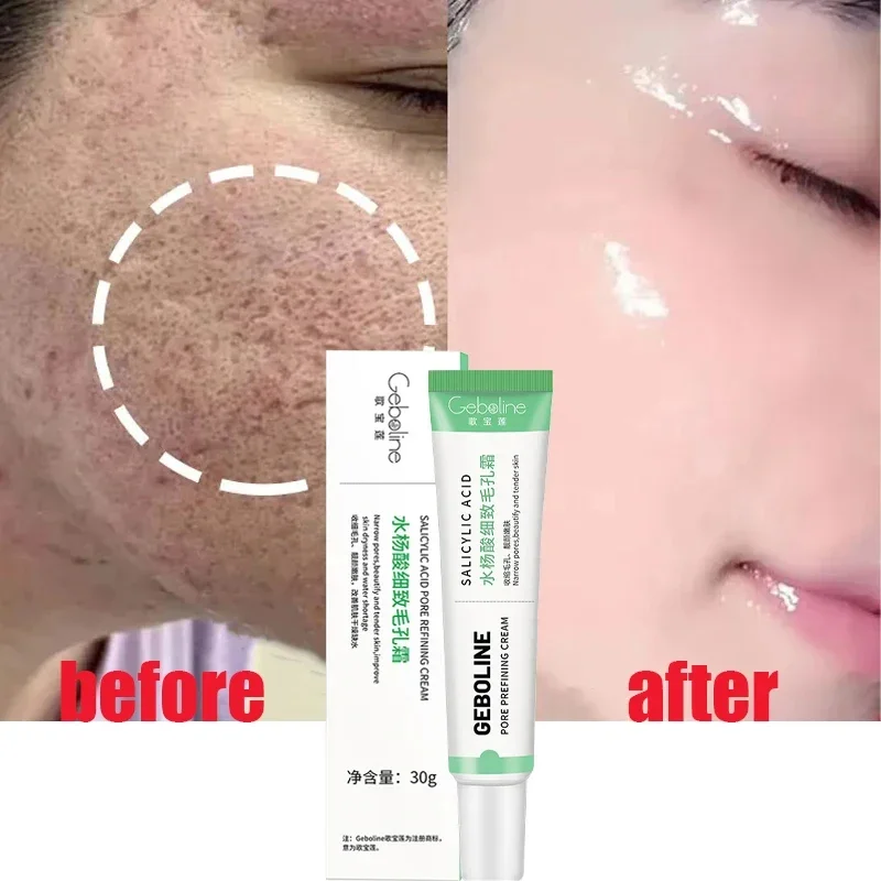 Salicylic Acid Pore Shrinking  – Skincare Salicylic Acid recenzja i cena