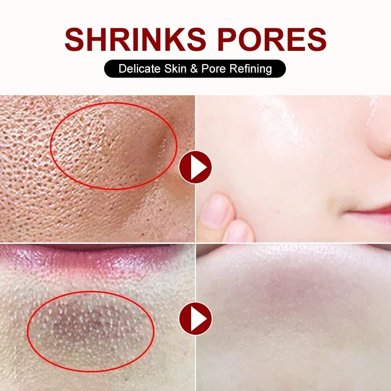 Salicylic Acid Pore Shrinking  – Skincare Salicylic Acid recenzja i cena