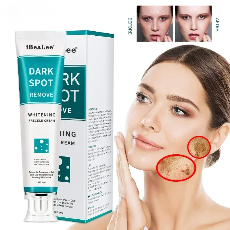 Whitening Freckle Cream Remove – Skincare Glowing recenzja i cena