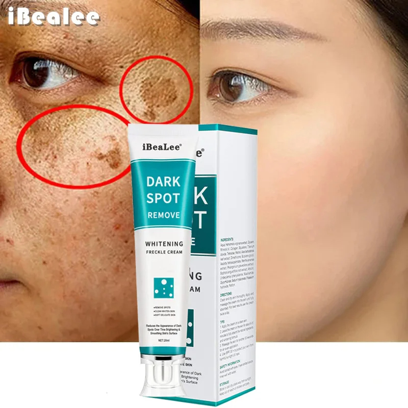 Whitening Freckle Cream Remove – Skincare Glowing recenzja i cena