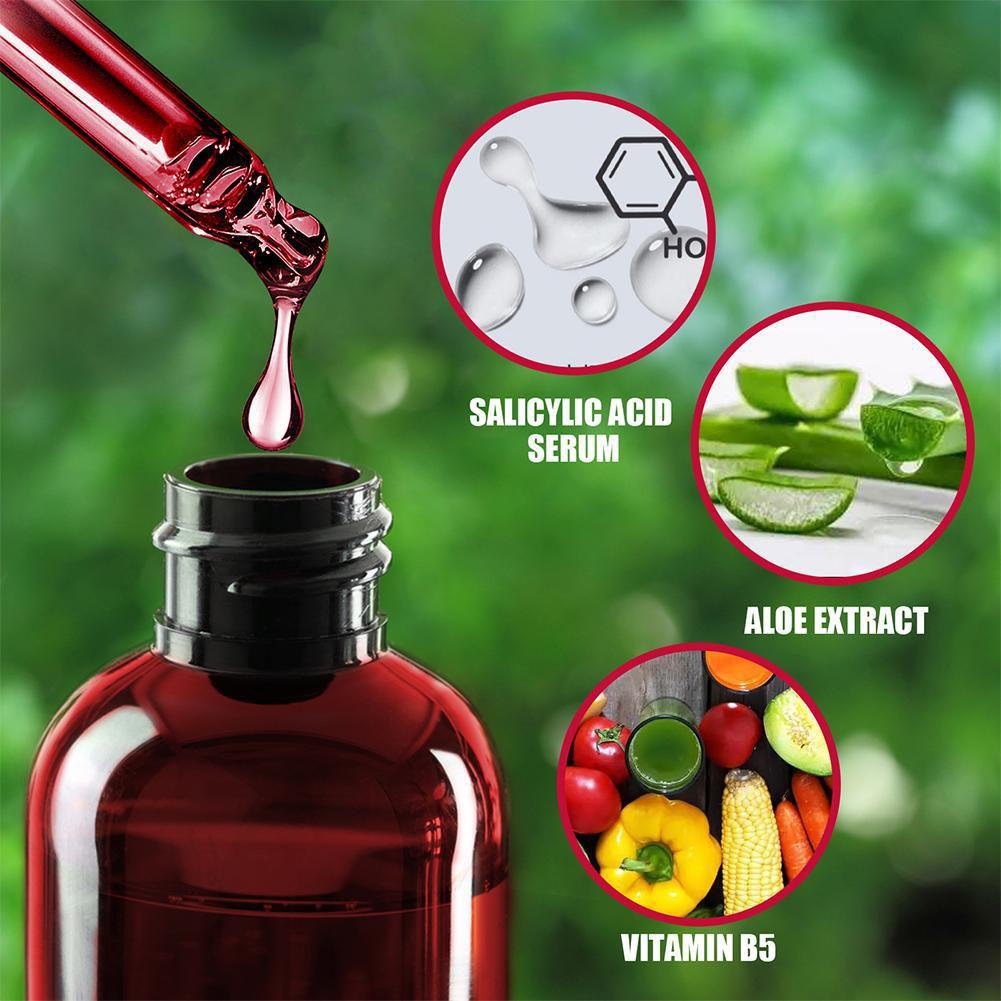 30ml Salicylic Acid Shrink Por – Azelaic Acid Serum recenzja i cena