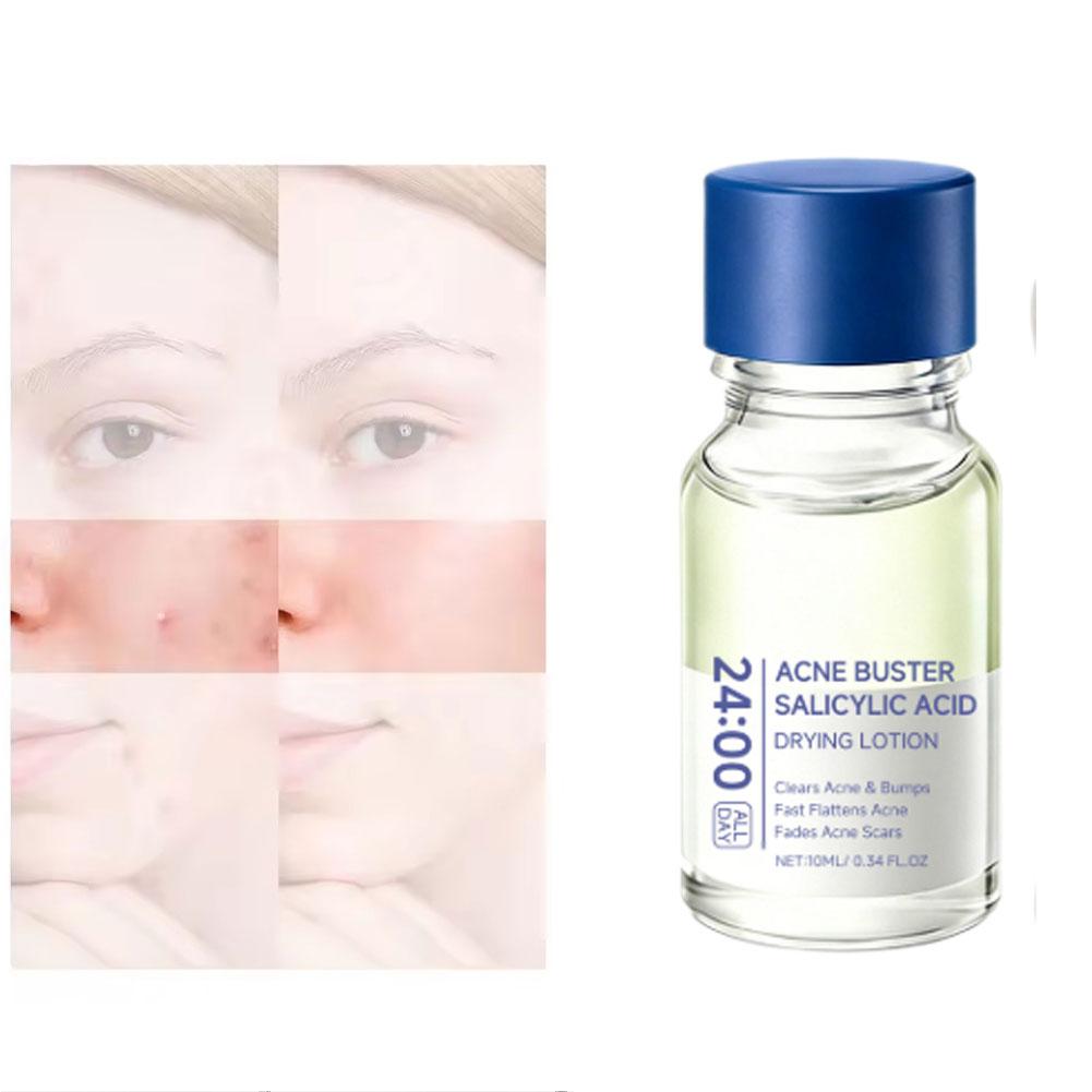 Salicylic Acid Acne Removal Fa – Azelaic Acid Serum recenzja i cena