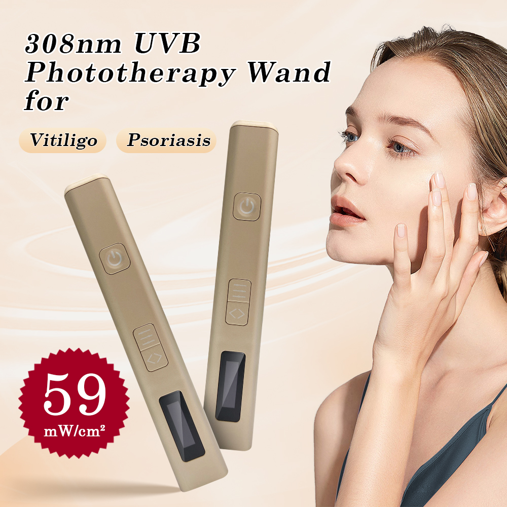 1PC Pen Shape 308nm LED UV lig – Skincare Glowing recenzja i cena